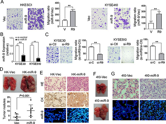 miR-9 promotes cell migration and tumor metastasis.