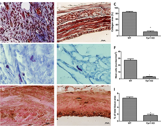 Effect of Fpr1 gene deletion on Masson trichrome staining, mast cells number and NGF expression.