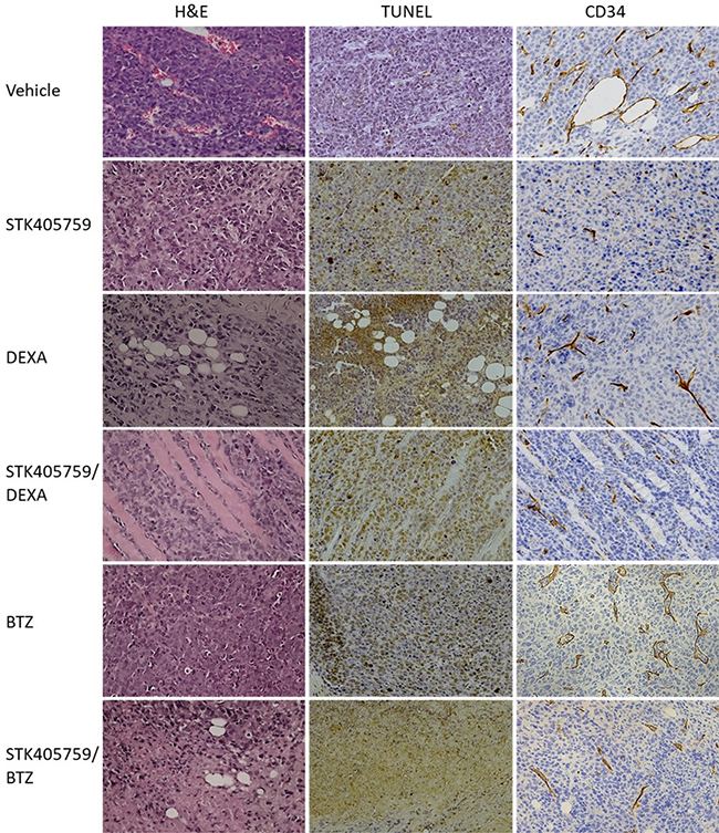 Effect of STK405759, DEXA, BTZ and their combinations on angiogenesis and tumor cell death.