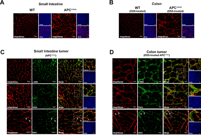 Confocal microscopy analysis of IntegriSense expression in small intestine adenomas and colorectal cancer.