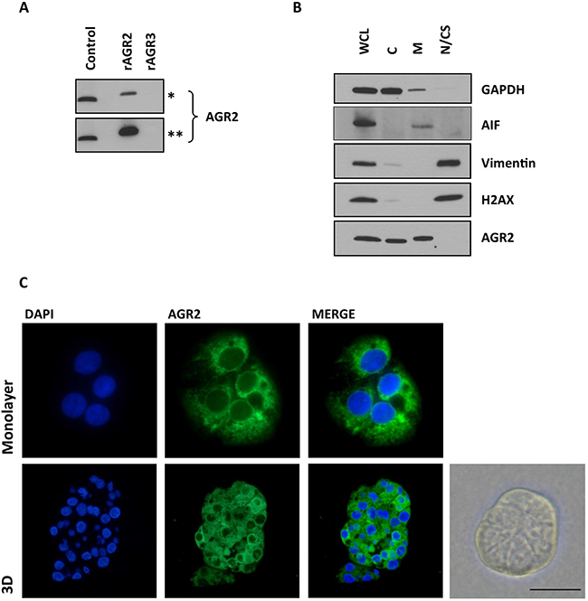 The pattern of AGR2 staining and specificity.