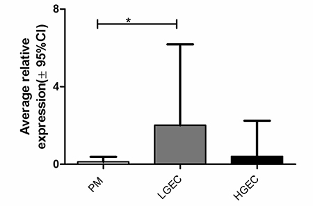 Average AGR2 mRNA level in human endometrial samples relative to the geometric mean of WYHAZ and PPIA; PM, postmenopausal; LGEC, low grade; HGEC, high grade endometrial cancer.