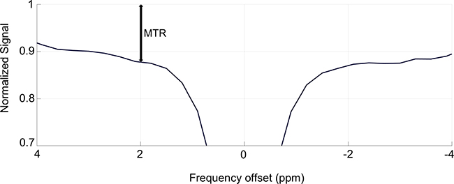 Graphical representation of the value of the magnetization transfer ratio (MTR).