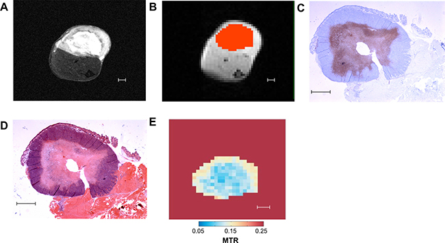 Representative images of different methods of tumor analysis employed in our study.