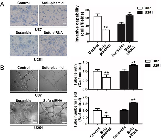Sufu suppressed invasion and vasculogenic mimicry of glioma cells.