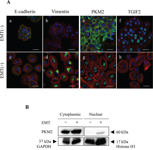 EMT induction alters subcellular localization of PKM2 and expression of TGIF2.