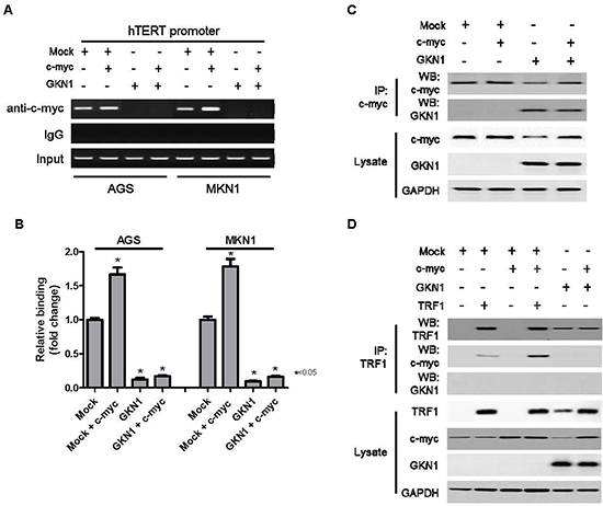 GKN1 directly binds to c-myc and inhibits c-myc-induced hTERT expression.