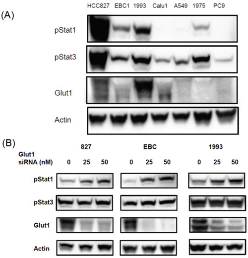 Effects of Glut1 knockdown on the expression of Stat signal pathway proteins in human lung cell lines.