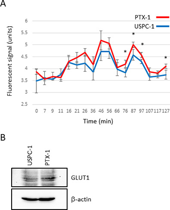 Glucose consumption and glucose transporter expression in uterine serous carcinoma cells.