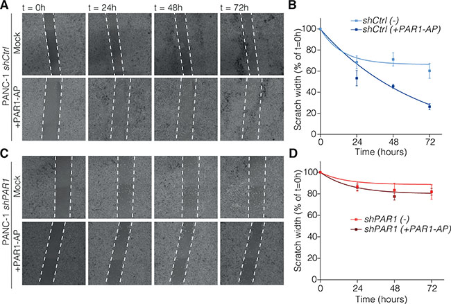 PAR-1 signaling contributes to tumor cell migration.