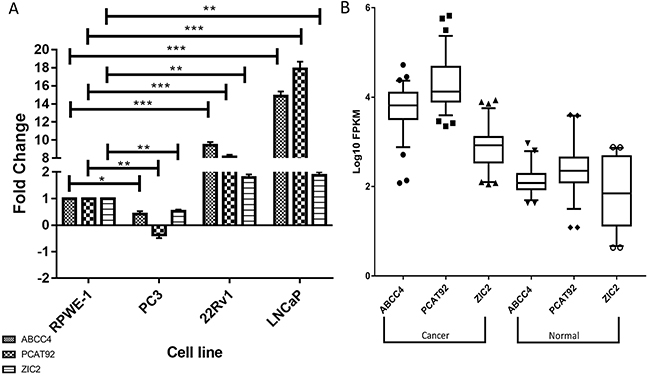 Expression profile of ABCC4, PCAT92 and ZIC2 in prostate cancer.