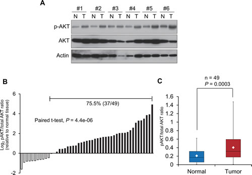 Constitutive activation of PI3K/AKT signaling pathway in esophageal cancer.