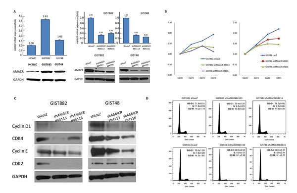 Figure-4: AMACR overexpression confers tumor aggressiveness by promoting in vitro growth of GIST cell lines.