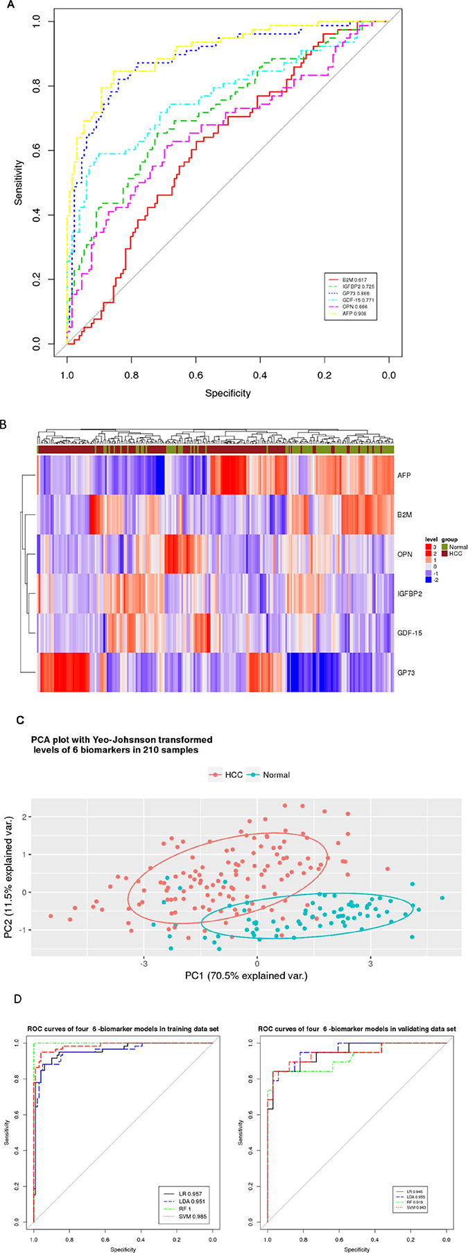 Classification analysis of 6 RPPA-measured proteins in 210 serum samples (132 HCC patients and 78 healthy controls) to evaluate their diagnostic performance as biomarkers of HCC.