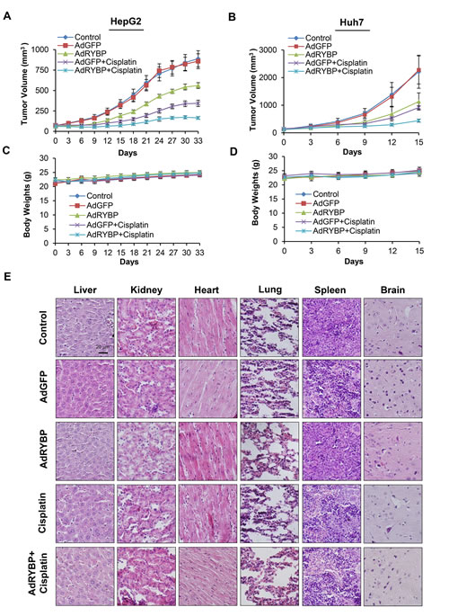 Fig.6: RYBP inhibits the growth of HCC and sensitizes HCC tumors to chemotherapy