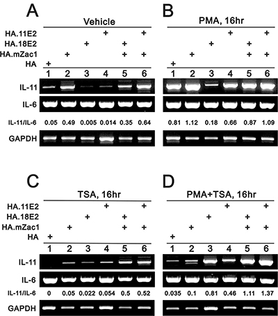 The rescue effect of Zac1 on HPV E2 proteins suppresses IL-11 mRNA expression.