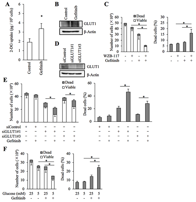 Role of facilitative glucose transport in gefitinib resistance of stem-like A549 cells.
