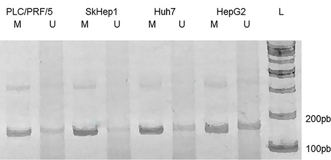 MS-PCR of the genomic region corresponding to the P1 promoter of PLAGL1 gene.