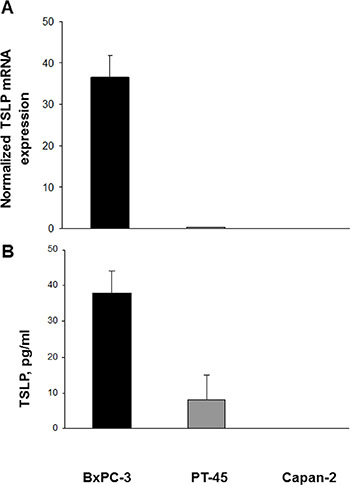 Expression of TSLP mRNA and protein in established pancreatic carcinoma cell lines.