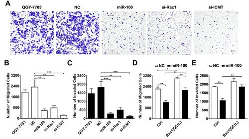 miR-100 exerts its anti-metastasis function by suppressing the ICMT-Rac1 signaling.