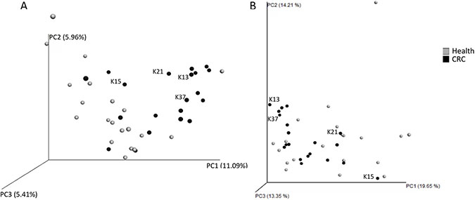 Beta-diversity analysis of faecal microbiota of healthy controls (grey) and colorectal cancer patients (black).