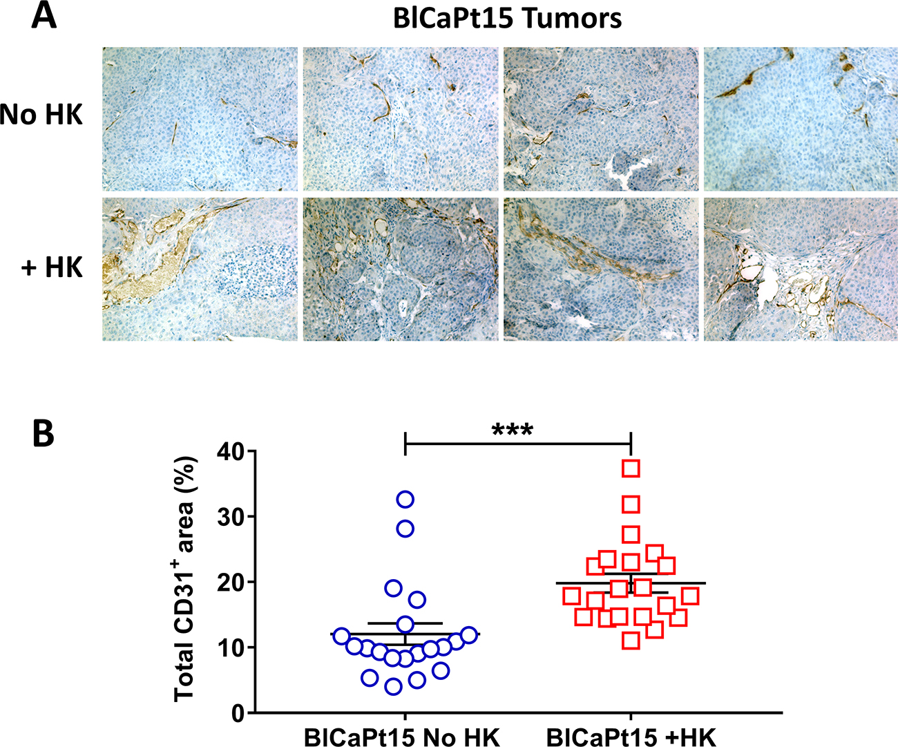 LN stromal HK cells support UCC tumor angiogenesis in the IB model.
