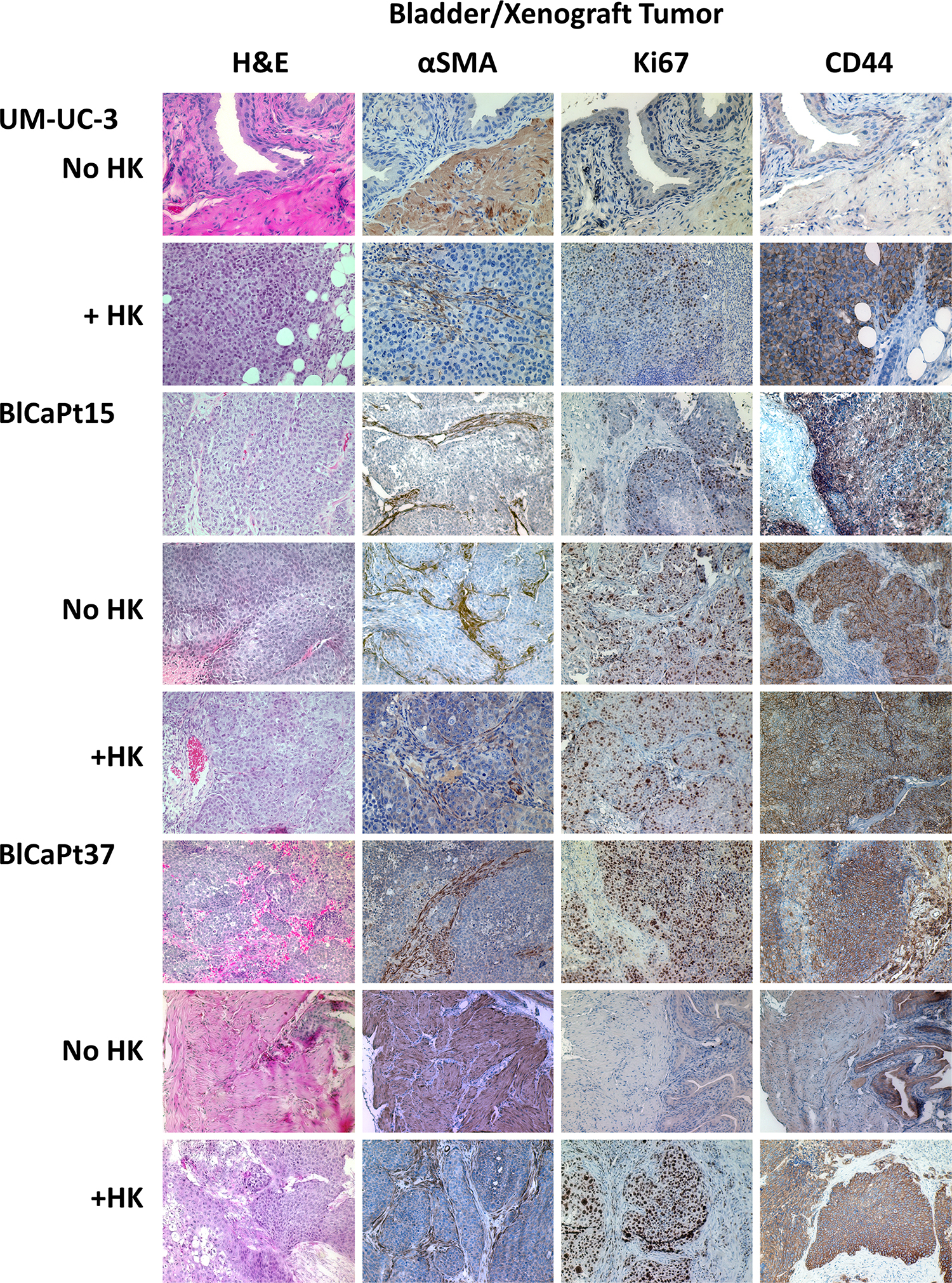 The IB model recapitulated the architectural and molecular expression characteristics of UCC patient primary tumors.
