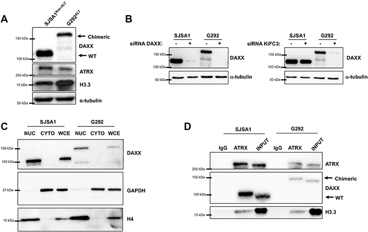 The DAXX-KIFC3 fusion leads to expression of a chimeric protein.