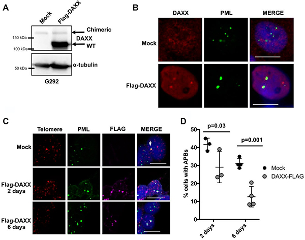 Expression of WT DAXX represses APB formation.