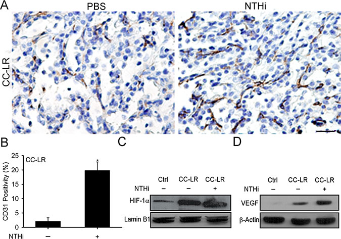 Promotion of K-ras induced lung tumorigenesis by inflammation is associated with increased angiogenesis and activation of the HIF-1&#x03B1; pathway.