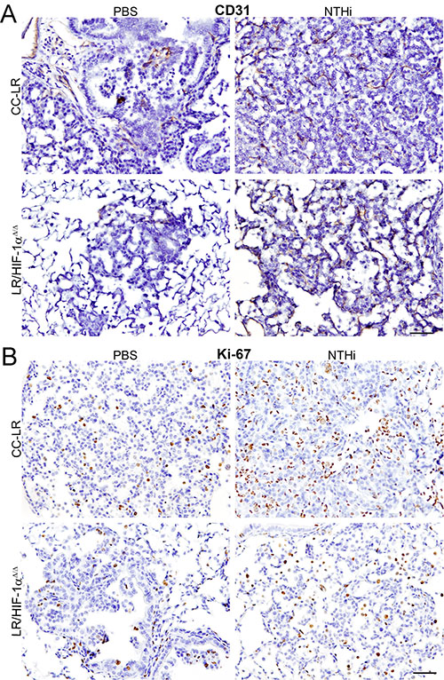Lack of HIF-1&#x03B1; in the airway epithelium suppresses tumor cell proliferation and angiogenesis.