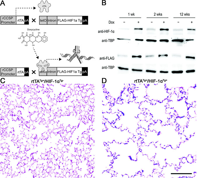 Structure and effect of the HIF-1&#x03B1; transgene expression in the airway epithelium.
