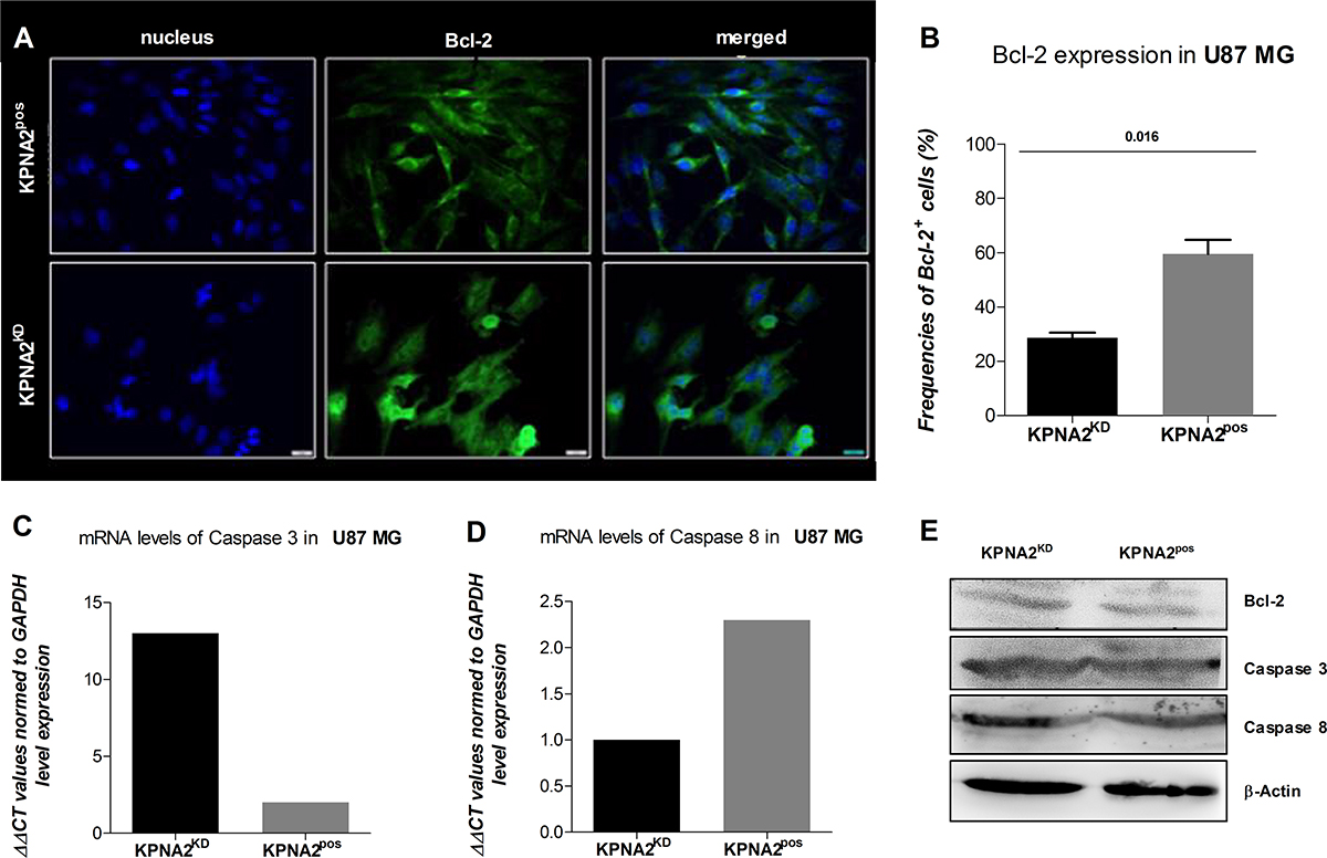 KPNA2 expression maintains survival and morphology of the GBM cell line U87 MG.