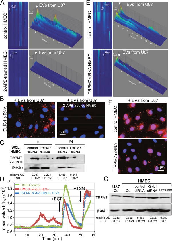 The vesicular transfer of CLIC1 requires cytosolic Ca2+ increases in HMEC.