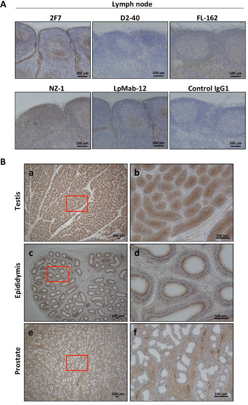 Podoplanin expression in normal tissue of Macaca fascicularis by immunohistochemical staining.