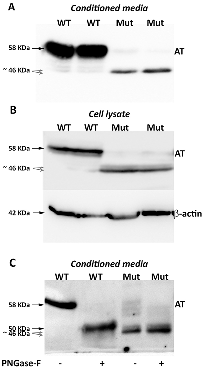 Antithrombins expressed by HEK-EBNA cells 24 h after transfection with pCEP4-S169A (WT) and pCEP4-S169A-M1I (Mut) plasmids.