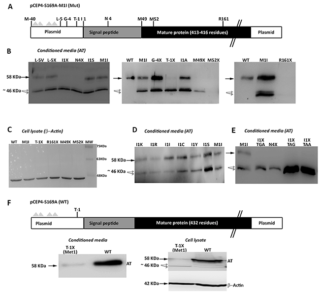 Identification of non AUG initiation codons in SERPINC1.