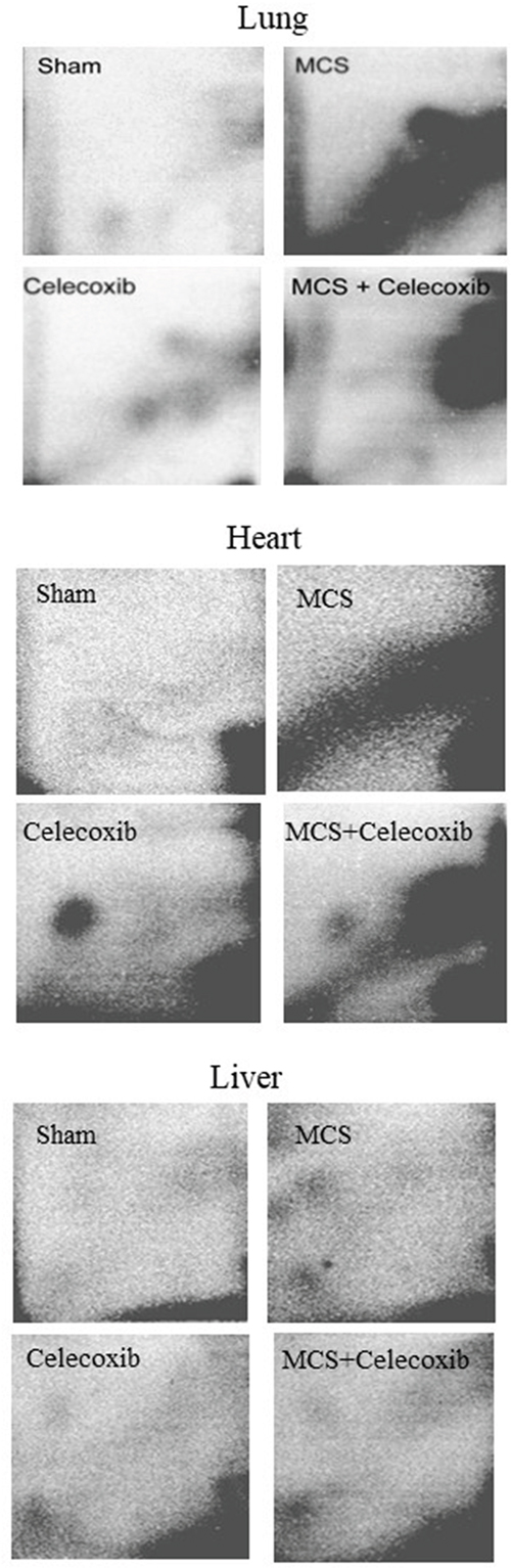Examples of 32P autoradiographs obtained by testing the lung, heart, and liver DNA from ICR (CD-1) mice, either untreated (sham-exposed) or treated with celecoxib for 6 weeks after weanling or exposed to MCS for 10 weeks since birth, in the absence of celecoxib, or exposed to MCS and treated with celecoxib.