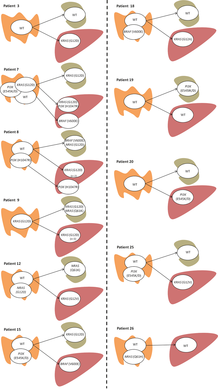 Intratumoral and intertumoral mutation heterogeneity of primary colorectal carcinomas as determined by the presence of different mutation status for KRAS, NRAS, PIK3 and BRAF genes.