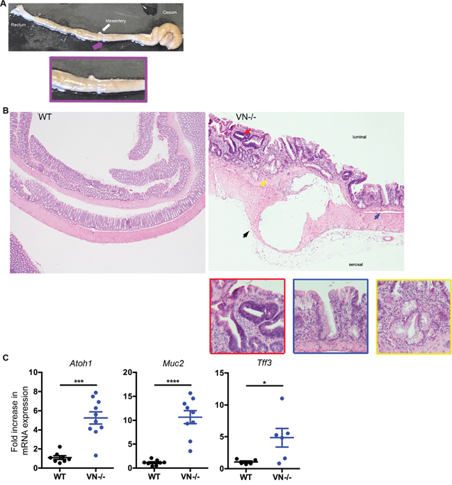 VN-/- mice are highly susceptible to spontaneous colorectal mucinous adenocarcinoma.