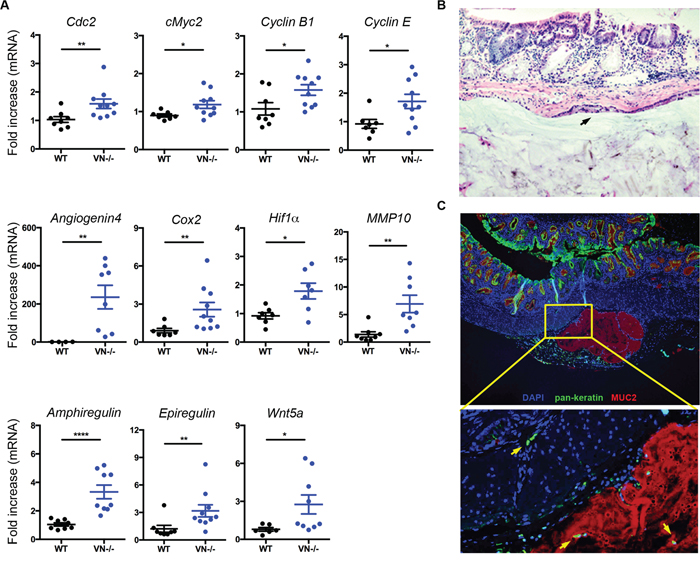 Notch-1 controls intestinal expression of pro-tumorigenic factors and tumor invasion.