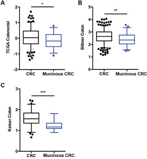 Notch-1 expression is downregulated in human colorectal mucinous adenocarcinoma.