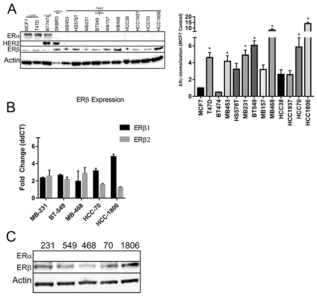 ER&beta; is expressed in TNBC cell lines.