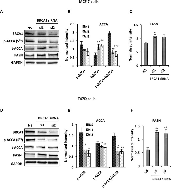 BRCA1 silencing up-regulates ACCA and FASN in MCF7 and T47D breast cancer cells.