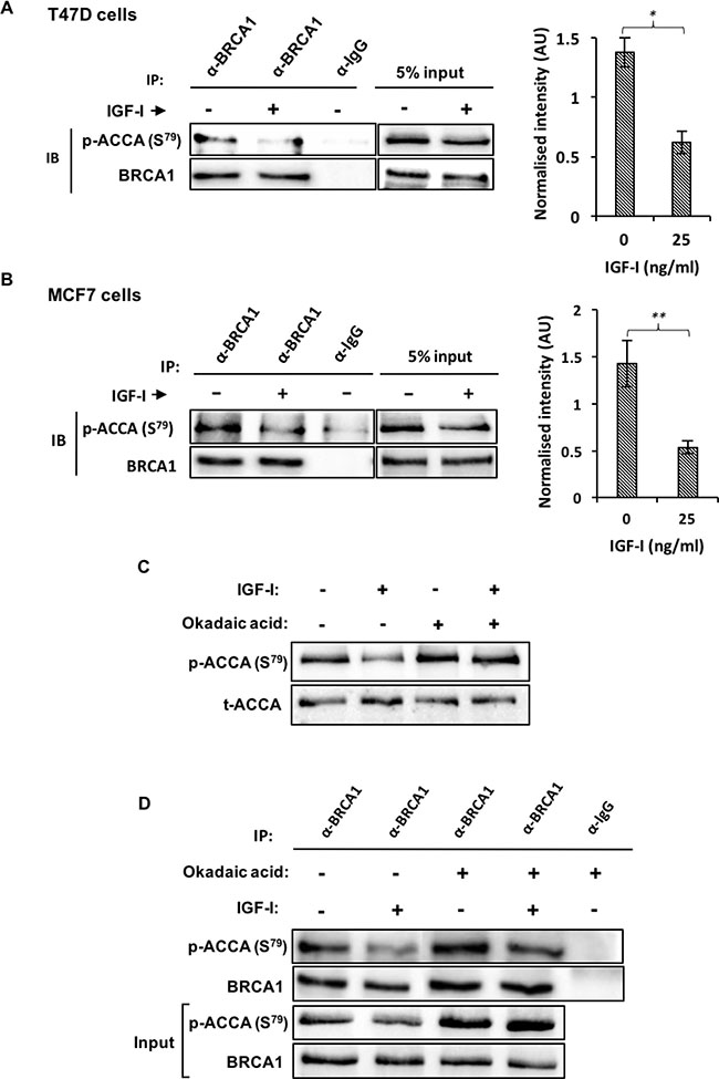IGF-I reduces the interaction between BRCA1 and p-ACCA (S79) in MCF7 and T47D ER-breast cancer cells.