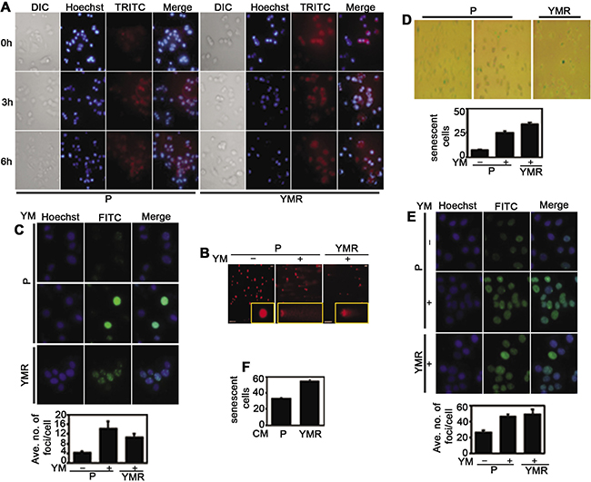 YMR cells undergo persistent DNA damage associated with chronic YM155 treatment.