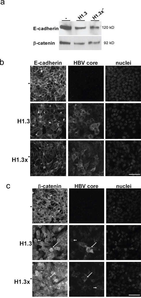 Distribution of E-cadherin/&#x03B2;-catenin in HBV-replicating hepatoma cells.