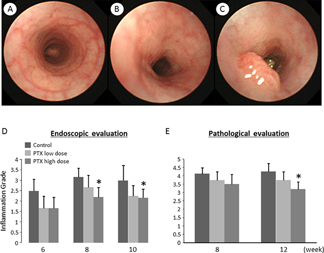 Endoscopic images and effects of pentoxifylline on AOM/DSS-induced inflammation and tumors in the colon of KAD rats.