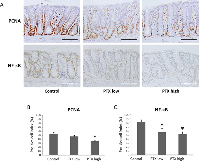 Effects of pentoxifylline on NF-&#x03BA;B activity and cell proliferative activity in colonic mucosa of experimental rats.