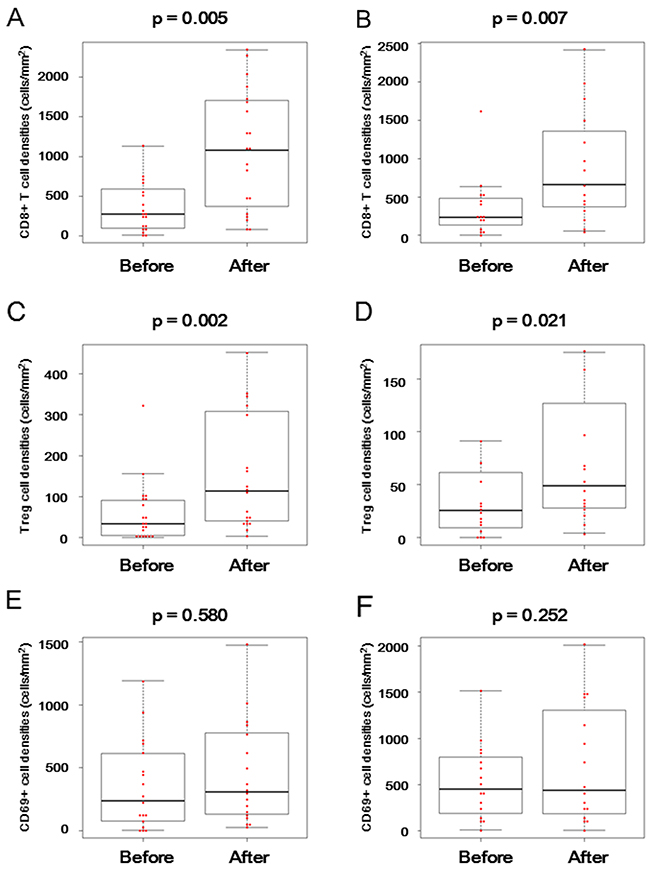 CD8&#x002B; T cell, FOXP3&#x002B; regulatory T cell, and CD69&#x002B; activated cell infiltration before and after BCG treatment in BCG-resistant patients.